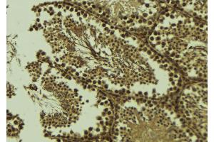 ABIN6273579 at 1/100 staining Mouse testis tissue by IHC-P. (ALKBH3 抗体  (Internal Region))