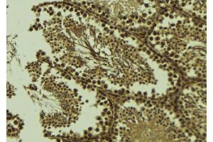 ABIN6273579 at 1/100 staining Mouse testis tissue by IHC-P. (ALKBH3 抗体  (Internal Region))