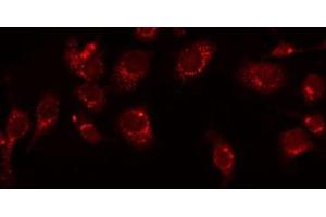 ABIN6277515 staining HeLa by IF/ICC. (KLKB1 抗体  (Internal Region))