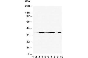 Western blot testing of Annexin V antibody and Lane 1:  rat brain;  2: rat skeletal muscle;  3: rat ovary;  4: rat lung;  5: MCF-7;  6: SMMC-7721;  7: A549;  8: Jurkat;  9: SGC;  10: HT1080;  Predicted molecular weight ~36 kDa. (Annexin V 抗体  (AA 88-102))