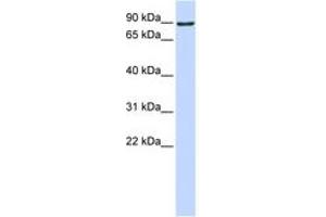 Image no. 1 for anti-ATM Interactor (ATMIN) (AA 576-625) antibody (ABIN6742283) (ATM Interactor 抗体  (AA 576-625))
