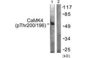 Western blot analysis of extracts from K562 cells treated with H2O2 100uM 30', using CaMK4 (Phospho-Thr196/200) Antibody. (CAMK4 抗体  (pThr200))