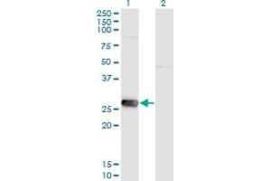 Western Blot analysis of SIRT3 expression in transfected 293T cell line by SIRT3 monoclonal antibody (M09), clone 1A4.