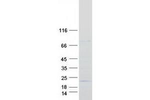 Western Blotting (WB) image for Proline Rich 13 (PRR13) (Transcript Variant 2) protein (Myc-DYKDDDDK Tag) (ABIN2729845)