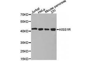 Western Blotting (WB) image for anti-KISS1 Receptor (KISS1R) antibody (ABIN1873420) (KISS1R 抗体)