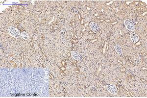 Immunohistochemical analysis of paraffin-embedded rat kidney tissue. (AMACR 抗体)