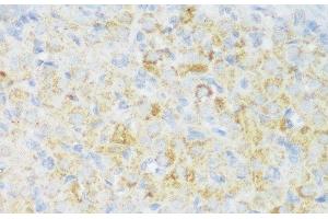 Immunohistochemistry of paraffin-embedded Rat ovary using CACNB3 Polyclonal Antibody at dilution of 1:150 (40x lens). (CACNB3 抗体)