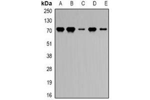 Western blot analysis of PRDM5 expression in HEK293T (A), mouse heart (B), mouse lung (C), rat kidney (D), rat liver (E) whole cell lysates. (PRDM5 抗体)