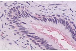 anti-Adhesion G-Protein Coupled Receptor G2 (ADGRG2) (C-Term) antibody