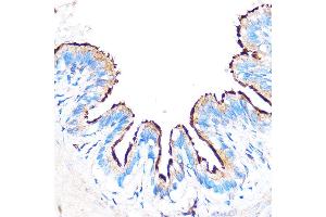 Immunohistochemistry (IHC) image for anti-Pyridoxal (Pyridoxine, Vitamin B6) Phosphatase (PDXP) (C-Term) antibody (ABIN7269758)