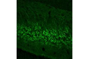 Indirect immunohystochemistry of a rat gyrus dentatus section (dilution 1 : 200). (NEFL 抗体  (AA 1-284))