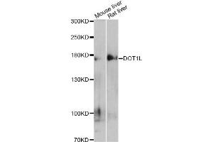 Western blot analysis of extracts of various cell lines, using DOT1L antibody (ABIN5997614) at 1/500 dilution. (DOT1L 抗体)