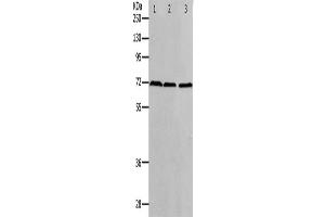 Western Blotting (WB) image for anti-Protein Arginine Methyltransferase 5 (PRMT5) antibody (ABIN2426359) (PRMT5 抗体)