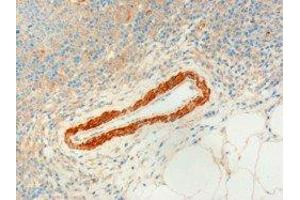 ABIN2560694 (3µg/ml) staining of paraffin embedded Human Lymph Node. (USP20 抗体  (C-Term))