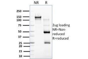 SDS-PAGE Analysis Purified RCAS1 Mouse Monoclonal Antibody (CPTC-EBAG9-2). (RCAS1 抗体)