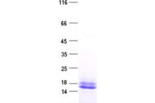 PPP4R4 Protein (His tag)