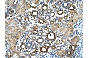 Immunohistochemistry (IHC) image for anti-Suppression of Tumorigenicity 14 (Colon Carcinoma) (ST14) (C-Term) antibody (ABIN2773910) (ST14 抗体  (C-Term))