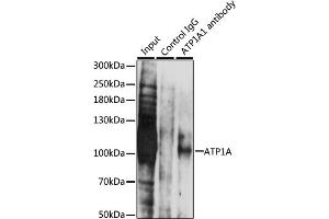 Immunoprecipitation analysis of 200 μg extracts of LO2 cells, using 3 μg  antibody (ABIN1512611, ABIN3021021, ABIN3021022, ABIN1513797 and ABIN6213916). (ATP1A (AA 551-850) 抗体)
