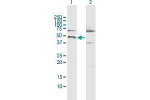 Western Blot analysis of CALU expression in transfected 293T cell line by CALU MaxPab polyclonal antibody.