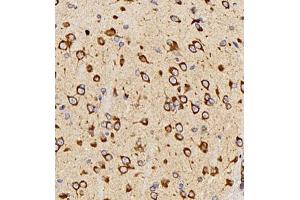 Immunohistochemistry (Paraffin-embedded Sections) (IHC (p)) image for anti-Neurotensin (NTS) antibody (ABIN7074827)