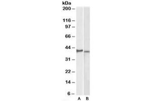 Western blot testing of KELLY [A] and U251-MG [B] lysates with CX3CR1 antibody at 2ug/ml. (CX3CR1 抗体)
