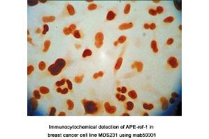 Image no. 7 for anti-DNA Repair Protein Apurinic Endonuclease antibody (ABIN5693483) (DNA Repair Protein Apurinic Endonuclease 抗体)