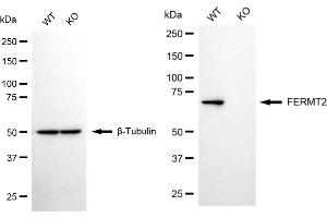 Western blotting analysis using FERMT2 antibody (ABIN7798592). (FERMT2 抗体)