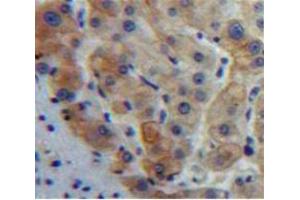 IHC-P analysis of Liver tissue, with DAB staining. (GDF5 抗体  (AA 382-501))