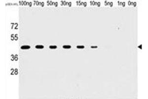 Western blot analysis of H1L antibody and recombinant H1L protein. (Tyr/ser Protein Phosphatase 抗体)