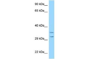 WB Suggested Anti-RPS2 Antibody Titration: 1. (RPS2 抗体  (Middle Region))