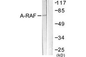 Western blot analysis of extracts from HeLa cells, treated with PMA 125ng/ml 30', using A-RAF (Ab-301/302) Antibody. (ARAF 抗体  (AA 276-325))