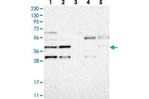 Western blot analysis of Lane 1: RT-4, Lane 2: U-251 MG, Lane 3: Human Plasma, Lane 4: Liver, Lane 5: Tonsil with MB21D1 polyclonal antibody . (C6orf150 抗体)