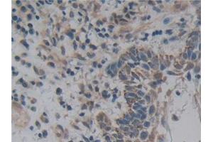 Immunohistochemistry (IHC) image for anti-Nuclear Factor kappa B (NFkB) (AA 805-892) antibody (ABIN7442525)