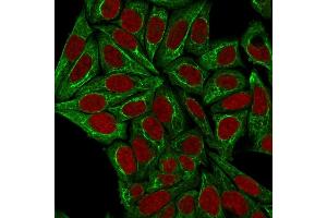 Immunofluorescence staining of HeLa cells using Pan-Cytokeratin Mouse Monoclonal Antibody (PCK/3150) followed by goat anti-Mouse IgG conjugated to CF488 (green). (KRT 抗体)