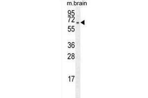 FBXO21 Antibody (C-term) (ABIN655273 and ABIN2844865) western blot analysis in mouse brain tissue lysates (35 μg/lane). (FBXO21 抗体  (C-Term))