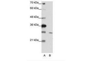 Image no. 2 for anti-Zinc Finger Protein 397 (ZNF397) (C-Term) antibody (ABIN202144) (ZNF397 抗体  (C-Term))