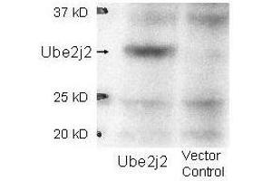 Western blot using  affinity purified anti-Ube2j2 antibody shows detection of Ube2j2 in 293 cells over-expressing Myc-Ube2j2 (Lane 1). (UBE2J2 抗体  (Internal Region))