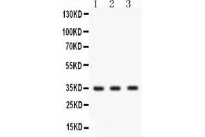 Western blot analysis of Cathepsin G expression in COLO320 whole cell lysates ( Lane 1), MCF-7 whole cell lysates ( Lane 2) and U20S whole cell lysates ( Lane 3). (Cathepsin G 抗体  (AA 25-252))