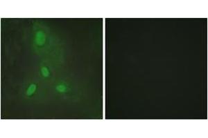 Immunofluorescence analysis of HeLa cells, using BACH1 Antibody. (BACH1 抗体  (AA 131-180))