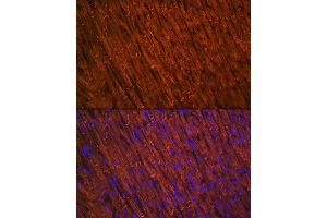 Immunohistochemistry of paraffin-embedded human colon using Desmin Rabbit mAb (ABIN1678733, ABIN3018020, ABIN3018021 and ABIN7101569) at dilution of 1:100 (40x lens). (Desmin 抗体)