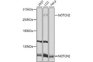 Western blot analysis of extracts of various cell lines, using NOTCH2 antibody (ABIN6132419, ABIN6144736, ABIN6144737 and ABIN6213887) at 1:1000 dilution. (NOTCH2 抗体  (AA 2242-2471))