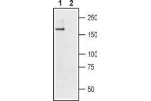 Western blot analysis of rat brain membrane: - 1. (SCN11A 抗体  (Intracellular))