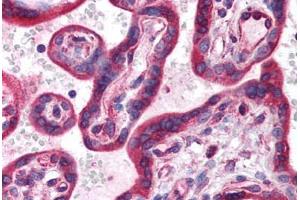 Human Placenta (formalin-fixed, paraffin-embedded) stained with HIF3A antibody ABIN214599 at 5 ug/ml followed by biotinylated goat anti-rabbit IgG secondary antibody ABIN481713, alkaline phosphatase-streptavidin and chromogen. (HIF3A 抗体  (AA 581-592))