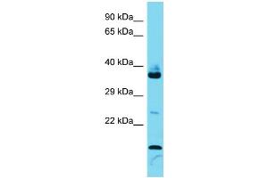 Host: Rabbit  Target Name: Fam133b  Sample Tissue: Mouse Thymus lysates  Antibody Dilution: 1. (FAM133B 抗体  (Middle Region))