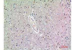 Immunohistochemistry (IHC) analysis of paraffin-embedded Human Brain, antibody was diluted at 1:200. (GDF7 抗体  (Internal Region))