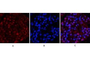 Immunofluorescence analysis of rat kidney tissue. (TUBB 抗体  (AA 370-450))