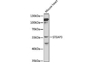 Western blot analysis of extracts of mouse heart, using STE antibody (ABIN3021067, ABIN3021068, ABIN3021069 and ABIN6213936) at 1:1000 dilution. (STEAP3 抗体  (AA 1-180))