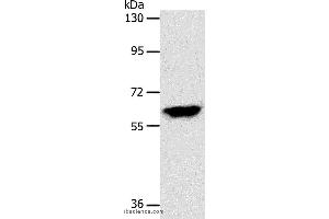Western blot analysis of Mouse brain tissue, using INA Polyclonal Antibody at dilution of 1:500 (INA 抗体)