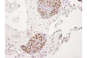Immunohistochemistry (IHC) image for anti-Heterogeneous Nuclear Ribonucleoprotein U (Scaffold Attachment Factor A) (HNRNPU) (AA 450-500) antibody (ABIN7448599)