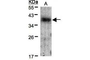 Image no. 2 for anti-V-Crk Sarcoma Virus CT10 Oncogene Homolog (Avian) (CRK) (AA 122-302) antibody (ABIN467422) (Crk 抗体  (AA 122-302))